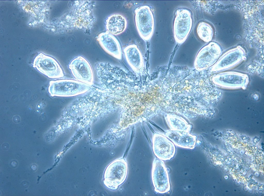 Mikroskopische Aufnahme des Belebtschlamms der Wiener Kläranlage, zu sehen sind Glockentierchen.