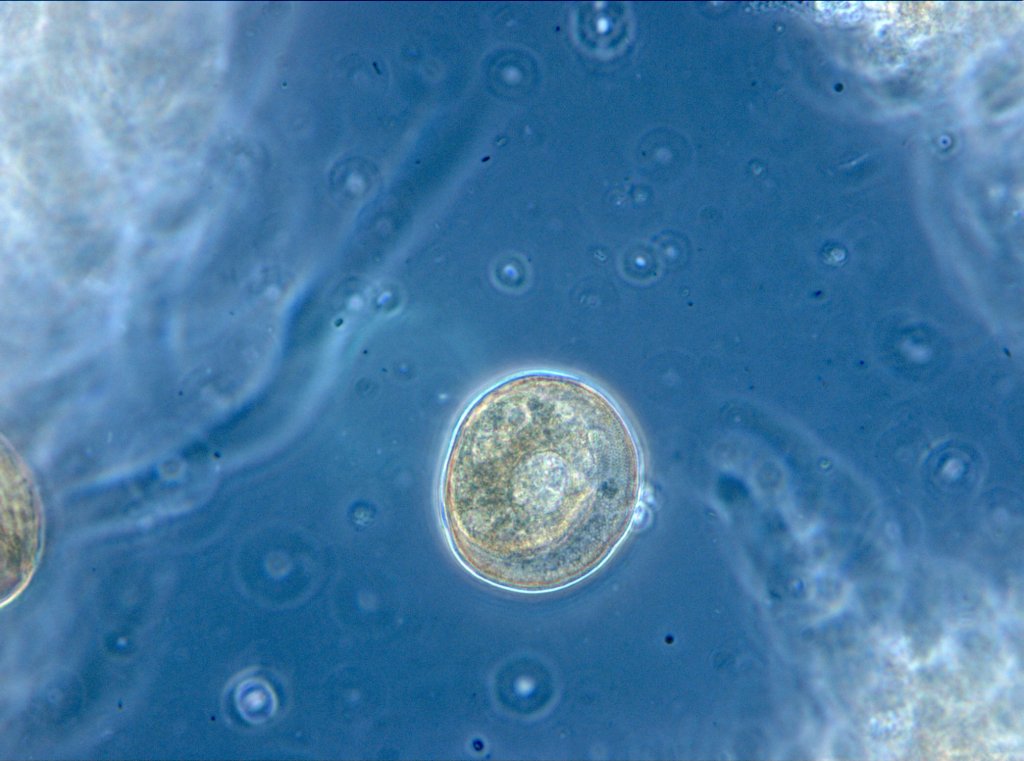 Mikroskopische Aufnahme des Belebtschlamms der Wiener Kläranlage, zu sehen ist eine Schalenamöbe.