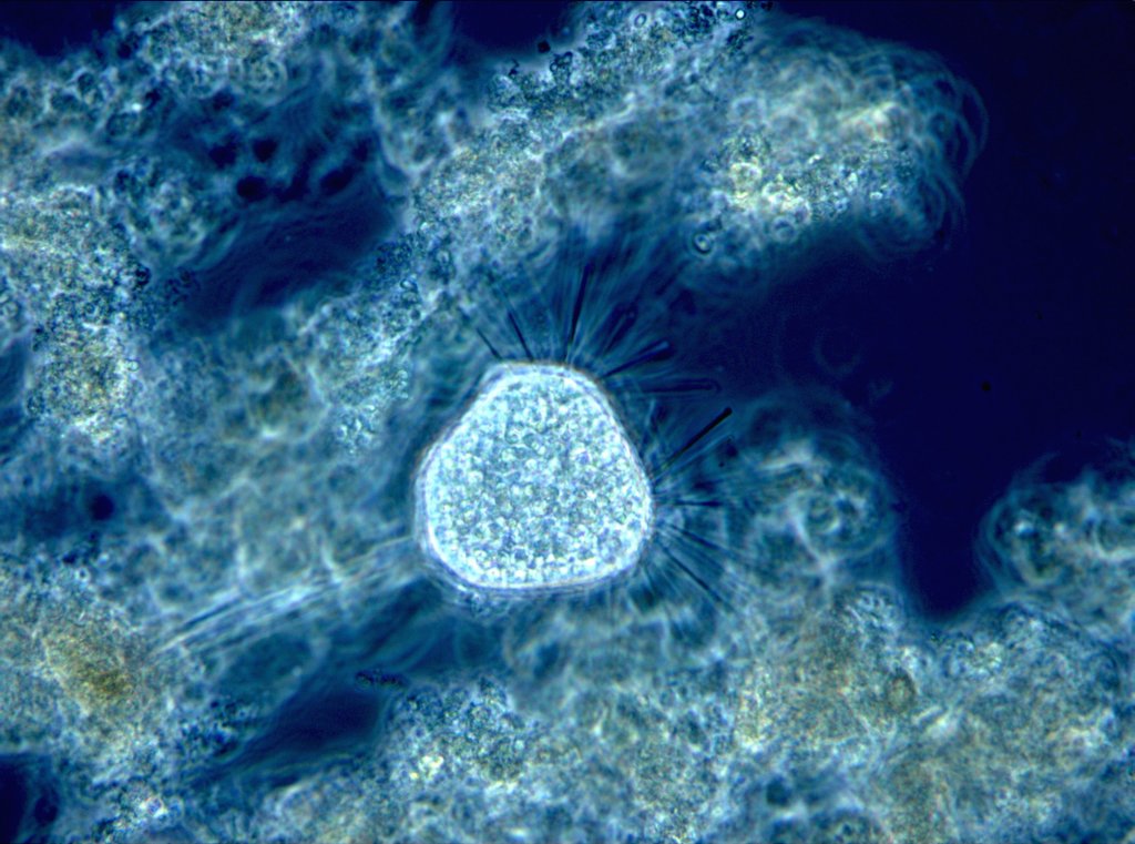 Mikroskopische Aufnahme des Belebtschlamms der Wiener Kläranlage, zu sehen sind Tokophrya.