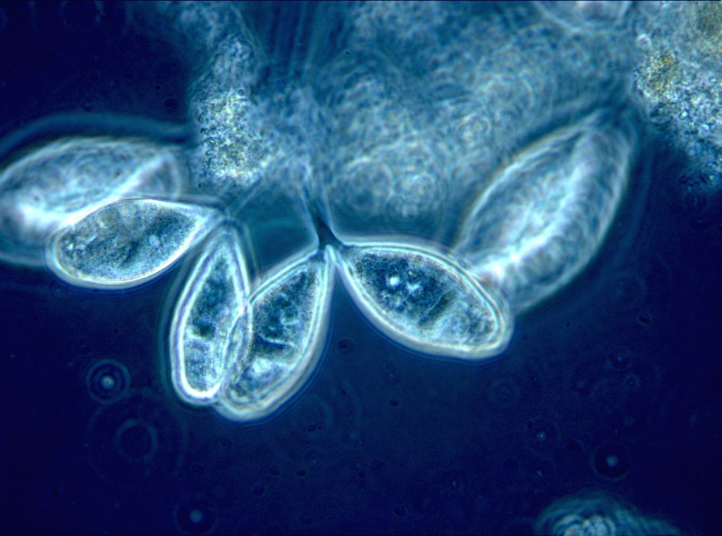Mikroskopische Aufnahme des Belebtschlamms der Wiener Kläranlage, zu sehen sind festsitzende Wimperntierchen.